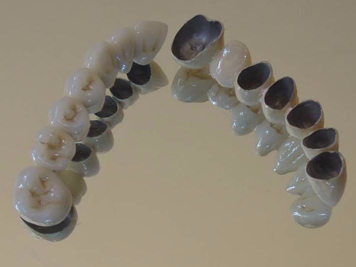 Porcelana Con Soporte De Metal