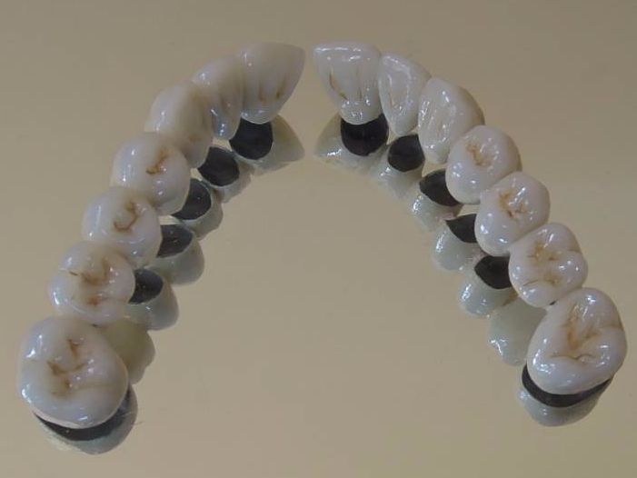 Porcelana Con Soporte De Metal